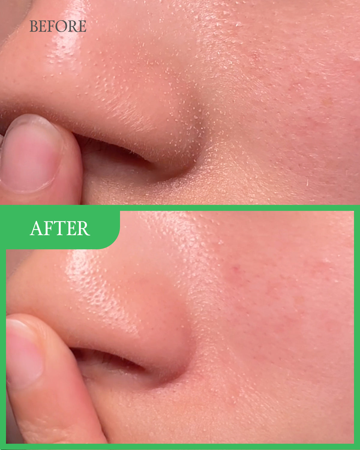 GreenGlow™ | Klei Masker Gezichtsreiniger